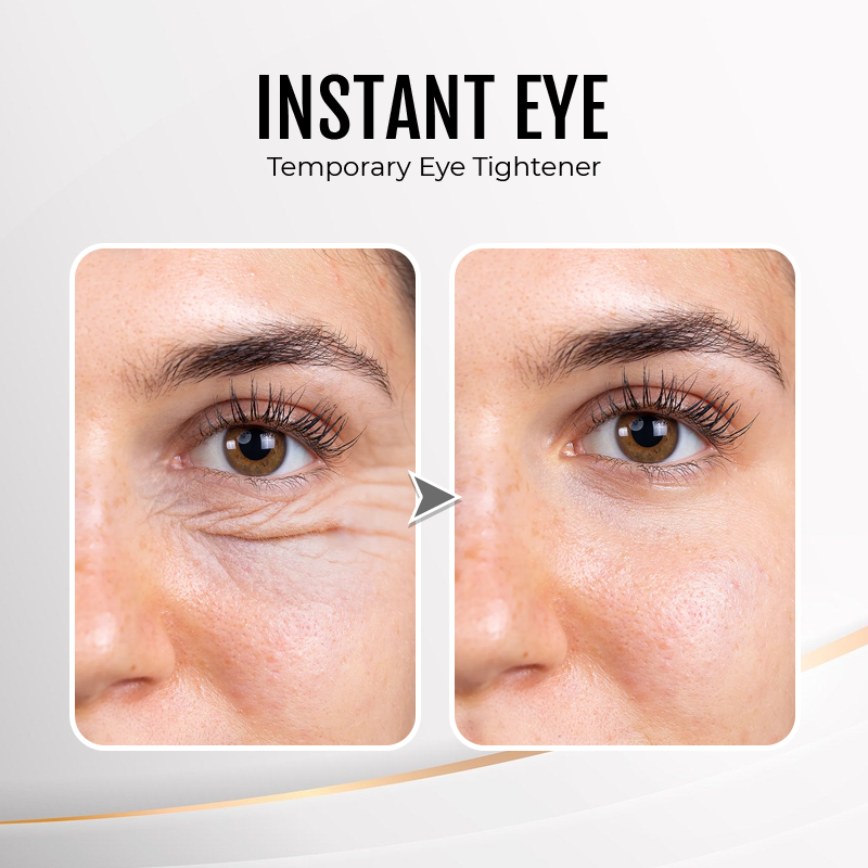 🔥 Last Day Discount: 87% OFF💐Instant Wrinkle Eye Tightener cream