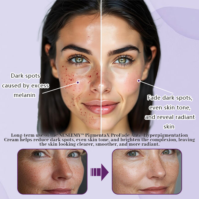PigmentaX ProFade Anti-Hyperpigmentation Cream