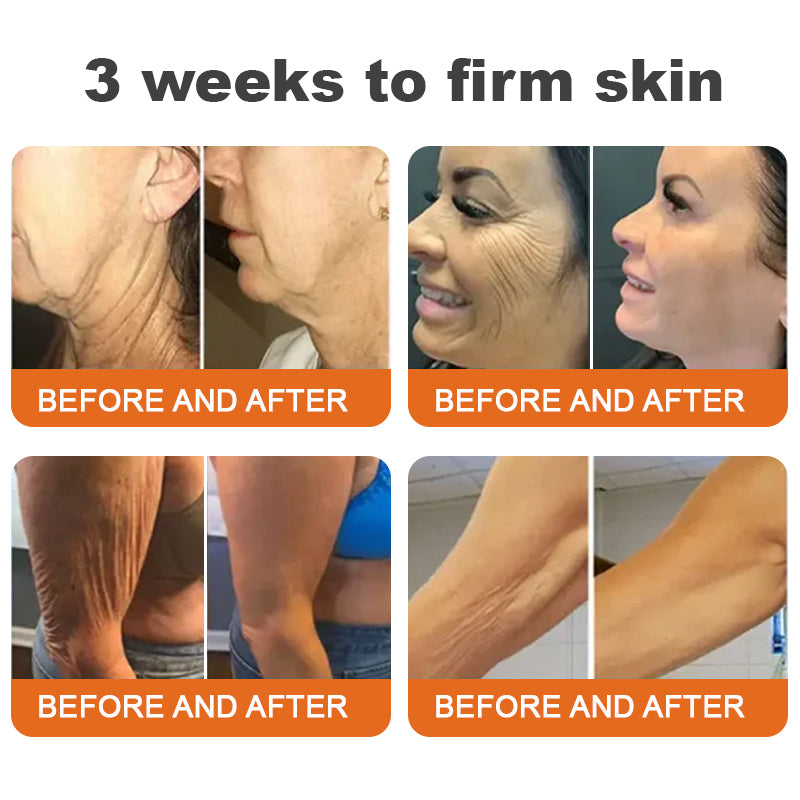 Made and Shipped from USA✨ BBOJI® Botulinum Toxin bee poison Firming Serum Stick(🔥LAST DAY 70% OFF)💄