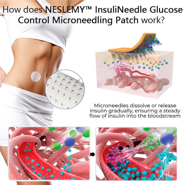 2025 NEW Tech✨NESLEMY™ InsuliNeedle Glucose Control Microneedling Patch