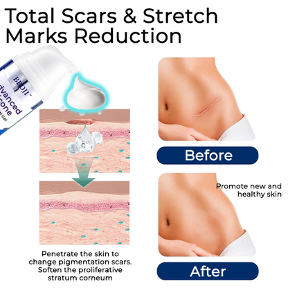 BBOJI™ Advanced Silicone Scar Removal Gel