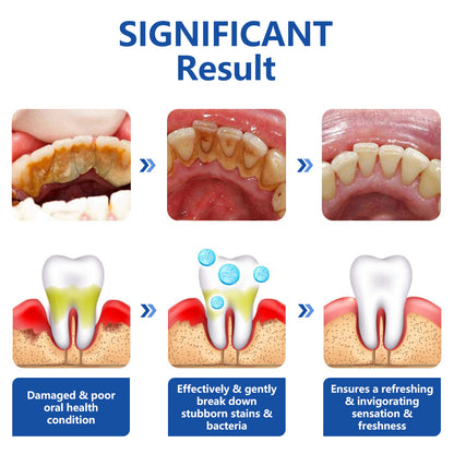 ✨HOT SALE💕GuruNanda Non Fluoride, Hydroxyapatite, Whitening Toothpaste