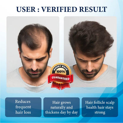 💥🩵[✨Last Day Discount:60% OFF✨] NESLEMY™ThickBoost Herbal HairGrowth Serum for Men(👨‍⚕AAD RECOMMENDS👨‍⚕)