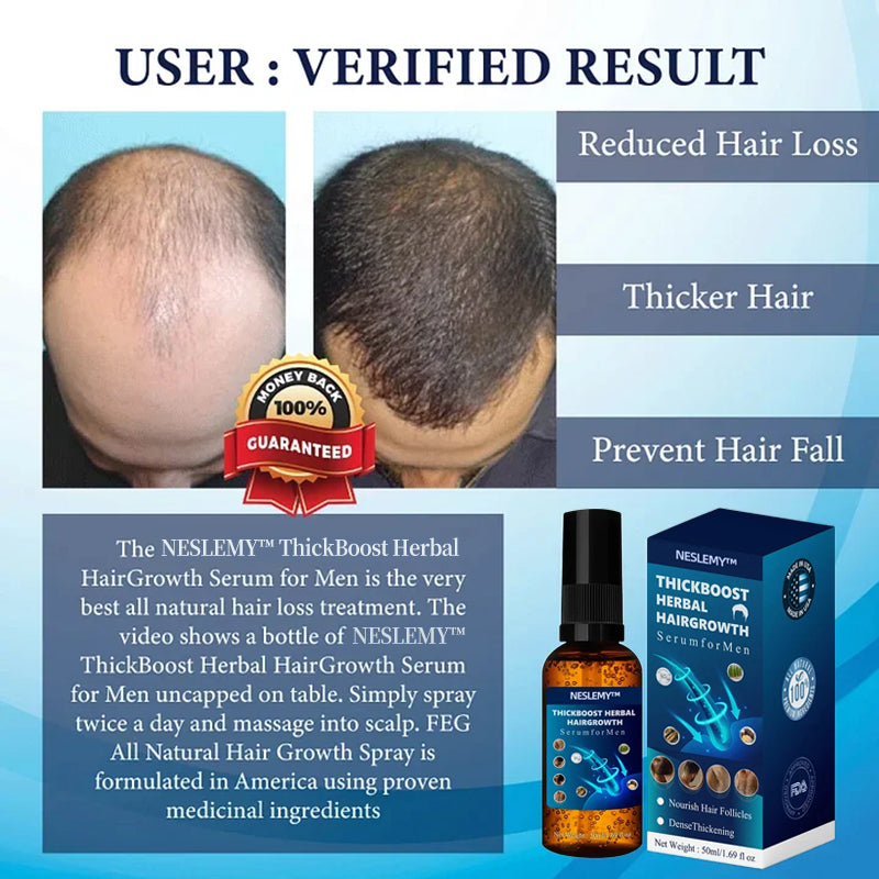 💥🩵[✨Last Day Discount:60% OFF✨] NESLEMY™ThickBoost Herbal HairGrowth Serum for Men(👨‍⚕AAD RECOMMENDS👨‍⚕)