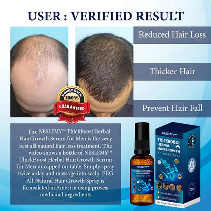 💥🩵[✨Last Day Discount:60% OFF✨] NESLEMY™ThickBoost Herbal HairGrowth Serum for Men(👨‍⚕AAD RECOMMENDS👨‍⚕)