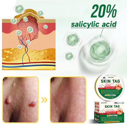 🌿NESLEMY™ 20% Salicylic Acid Skin Treatment Cream ✔️ Dermatologist-Approved ✔️ Safe & Fast-Acting Formula✔️ Helps with Warts, Psoriasis, Eczema, and More