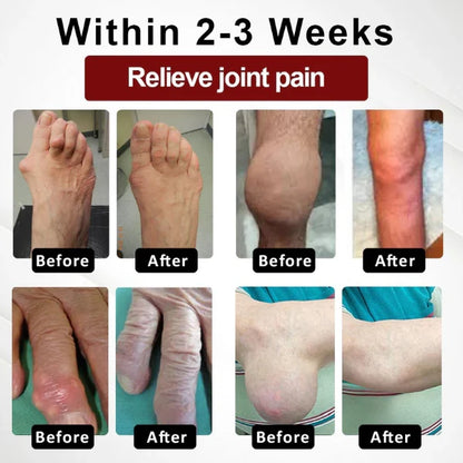 NESLEMY™ Horse Chestnut Arthritis Massage Cream