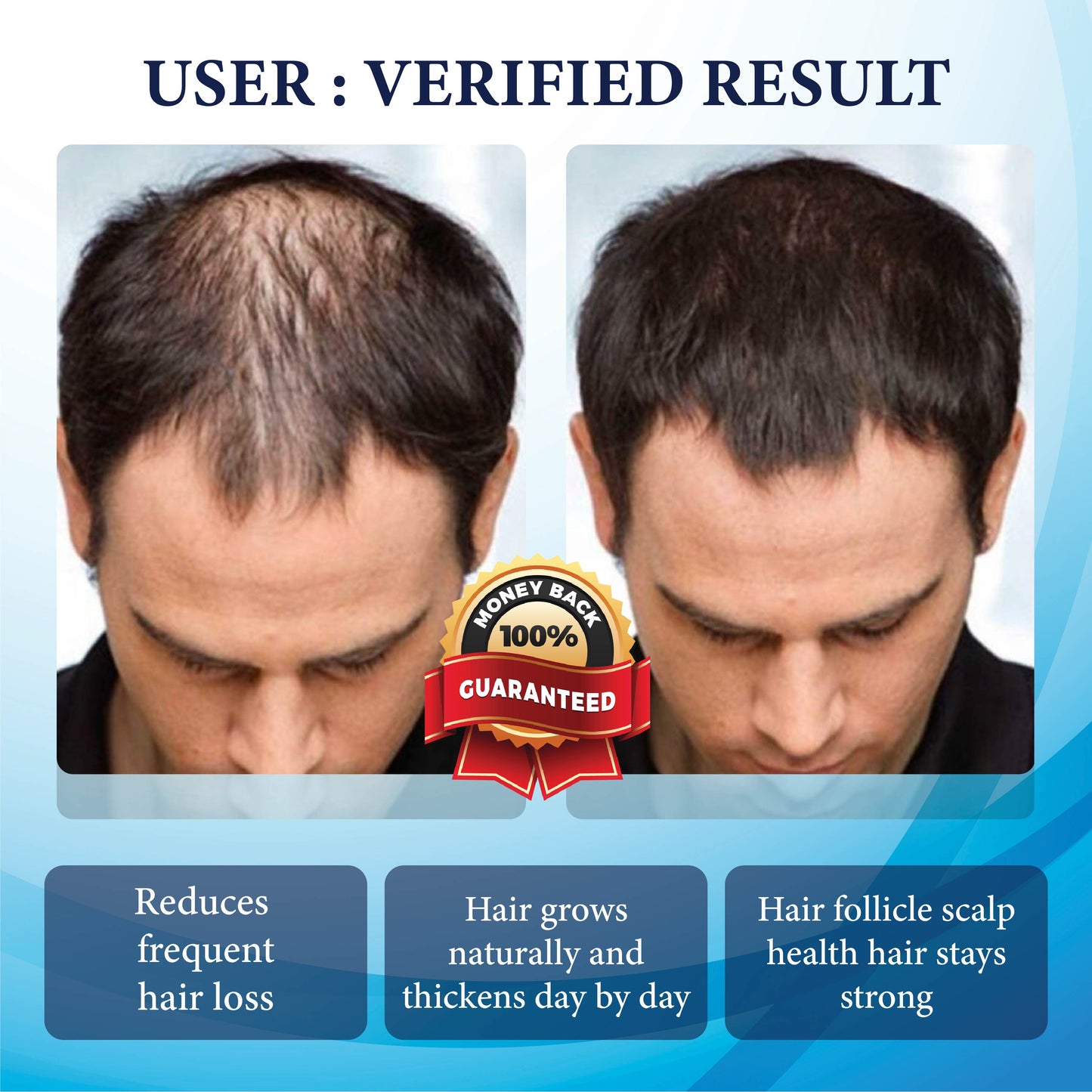 💥🩵[✨Last Day Discount:60% OFF✨] NESLEMY™ThickBoost Herbal HairGrowth Serum for Men(👨‍⚕AAD RECOMMENDS👨‍⚕)