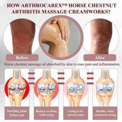 NESLEMY™ Horse Chestnut Arthritis Massage Cream