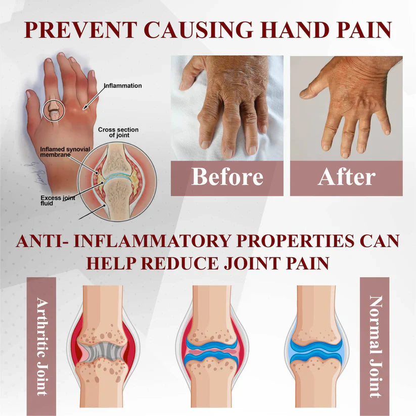 NESLEMY™ Horse Chestnut Arthritis Massage Cream