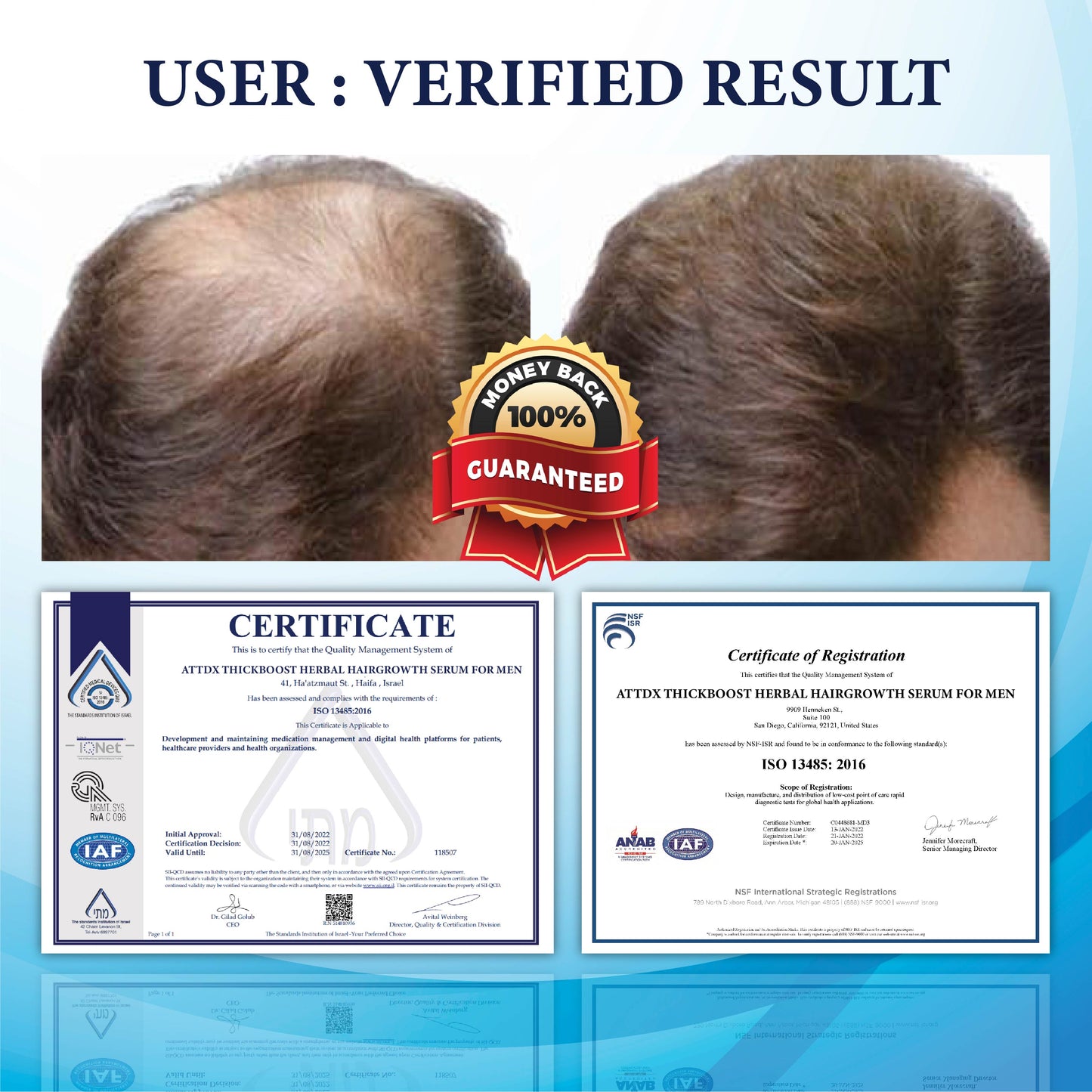💥🩵[✨Last Day Discount:60% OFF✨] NESLEMY™ThickBoost Herbal HairGrowth Serum for Men(👨‍⚕AAD RECOMMENDS👨‍⚕)