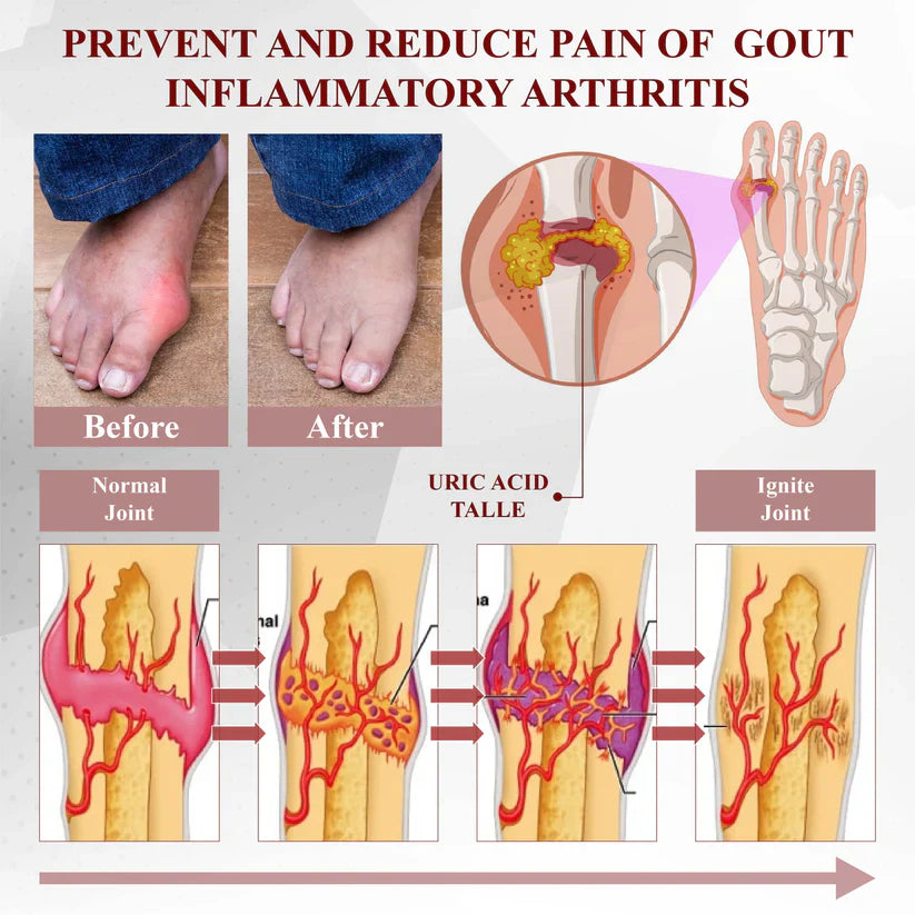 NESLEMY™ Horse Chestnut Arthritis Massage Cream