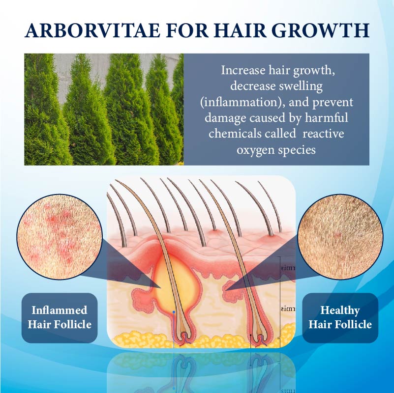 💥🩵[✨Last Day Discount:60% OFF✨] NESLEMY™ThickBoost Herbal HairGrowth Serum for Men(👨‍⚕AAD RECOMMENDS👨‍⚕)