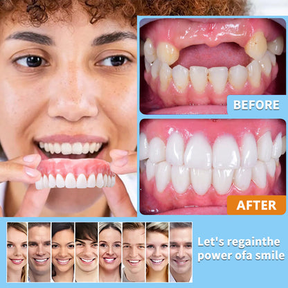 HZA™ --🦷Advanced Customized Full Denture Set🦷 (Recommended by the American Dental Association (ADA))