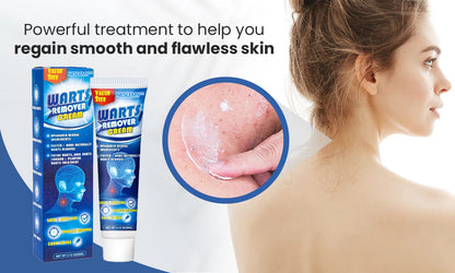 NESLEMY™ ClearWarts  Instant Blemish Removal Cream