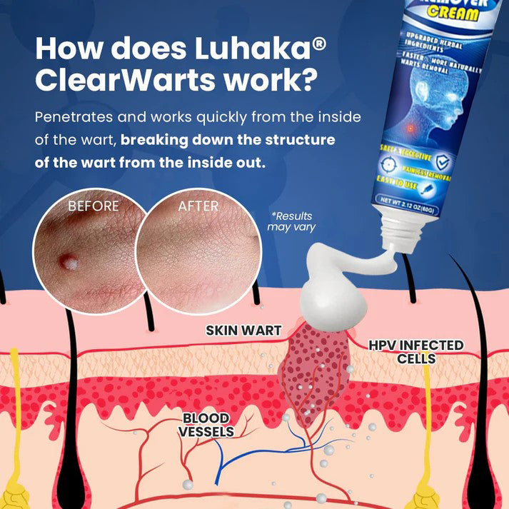 NESLEMY™ ClearWarts  Instant Blemish Removal Cream