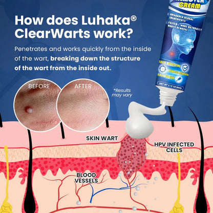 NESLEMY™ ClearWarts  Instant Blemish Removal Cream